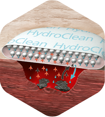 Ilustration showing the absorption capacities of HydroClean® plus.
