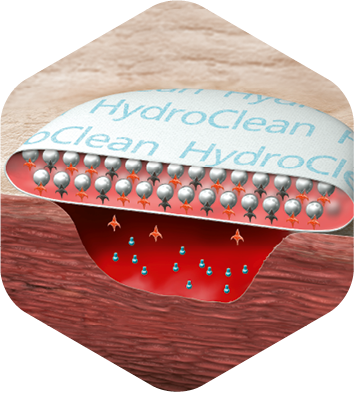 Illustration showing the ideal wound healing environment.