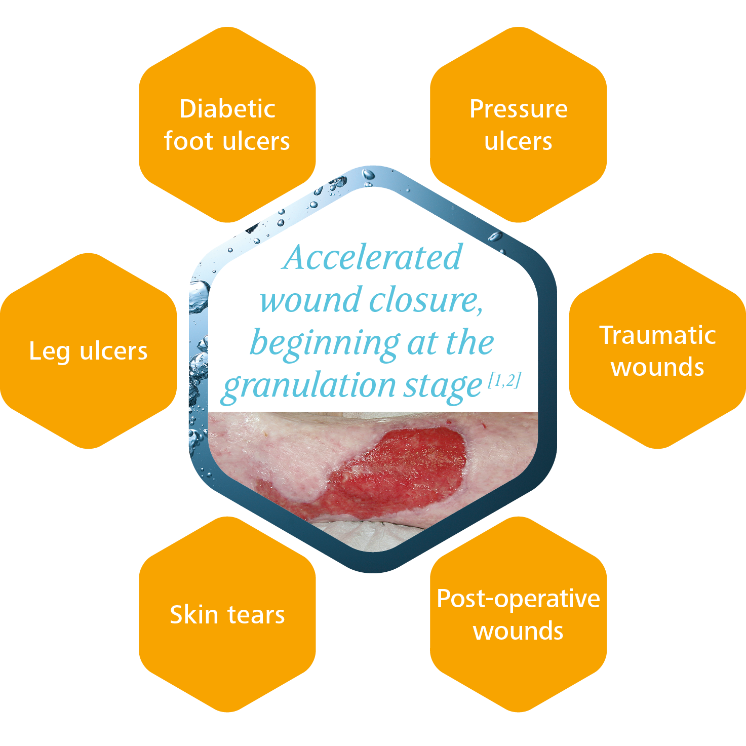 HydroTac can be used for a variety of wounds beginning at the granulation.