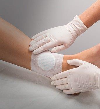 fixation wound treatment